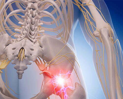 Read more about the article Totul despre segmentul spinal L4-L5