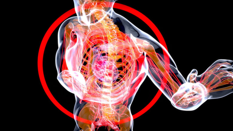 Read more about the article Nevralgie Intercostala Cluj-Napoca – Durere in Coaste la Respiratie | Chiromedica