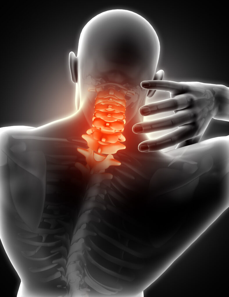 pain neck 1